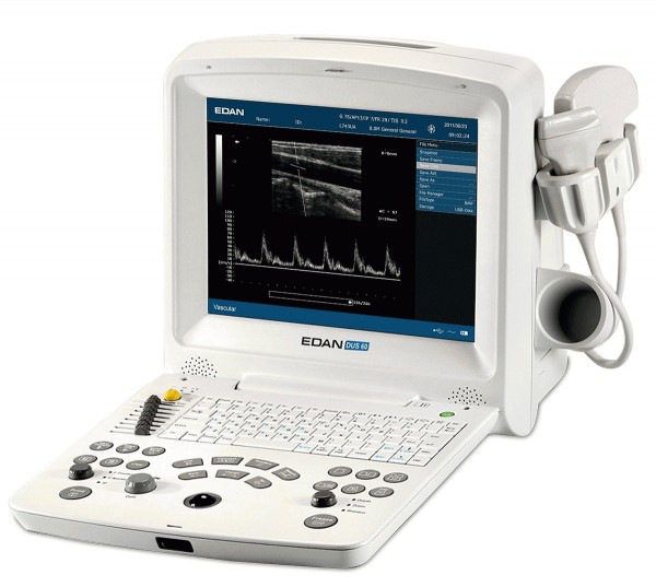DUS60 Edan DUS 60 Digital Ultrasonic Diagnostic Imaging System  