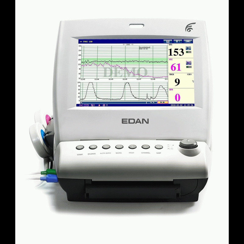Edan F6 Express Fetal Monitor with Maternal Parameters: ECG, HR/PR ...