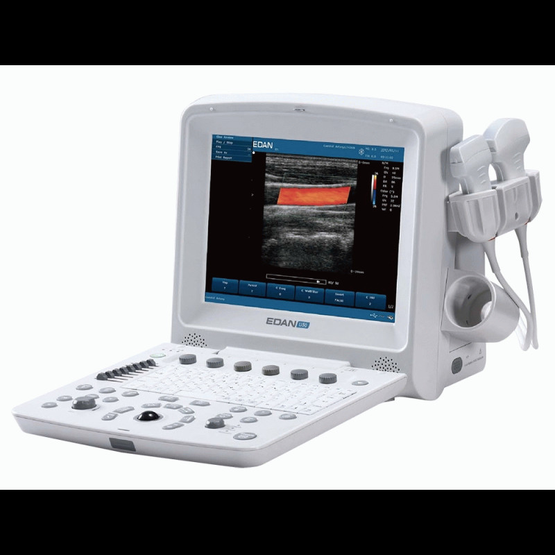 U50-PRIME Edan U50 Prime Imaging Ultrasound U50-PRIME Edan U50 Prime Imaging Ultrasound